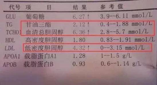 验血TG是什么_验血TG是什么指标