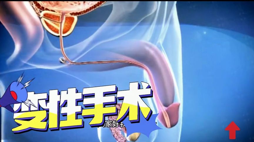 小男孩被抓做变性手术,小男孩做变性手术变成了女孩